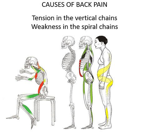 Causes of Back Pain