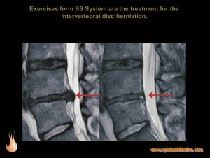 MRI Scan