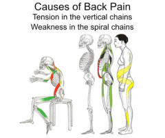 Causes of Back Pain